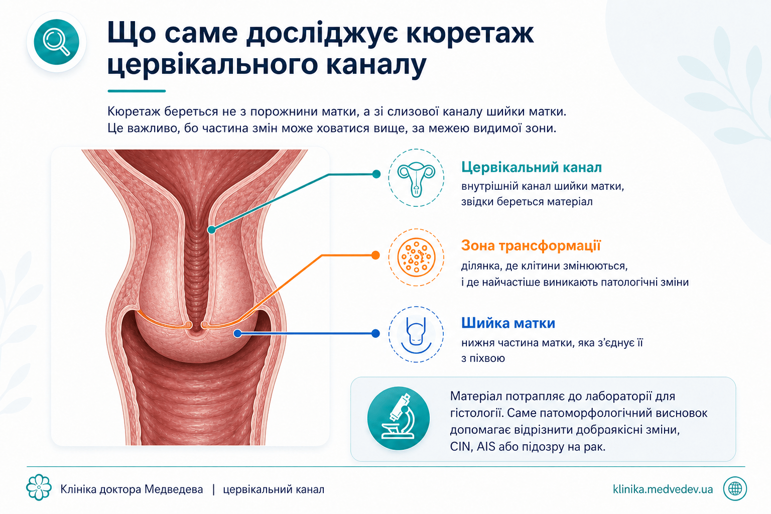 Схема цервікального каналу, зони трансформації і місця забору матеріалу під час ECC
