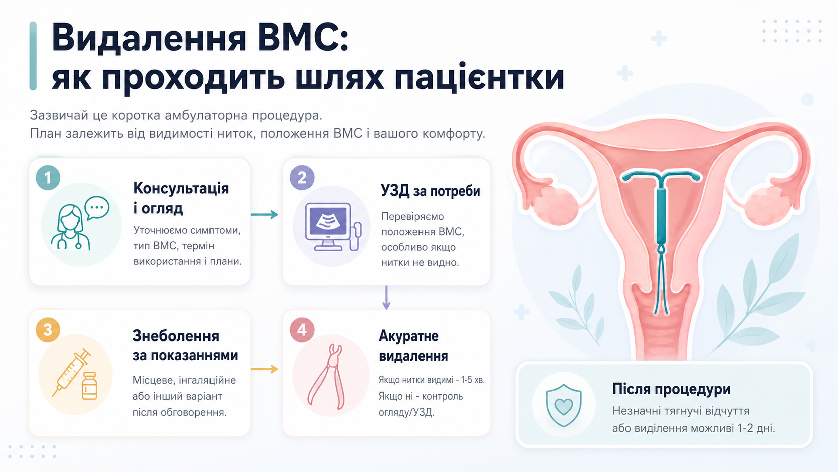 Інфографіка: консультація, УЗД за потреби, знеболення, акуратне видалення ВМС і післяпроцедурні рекомендації