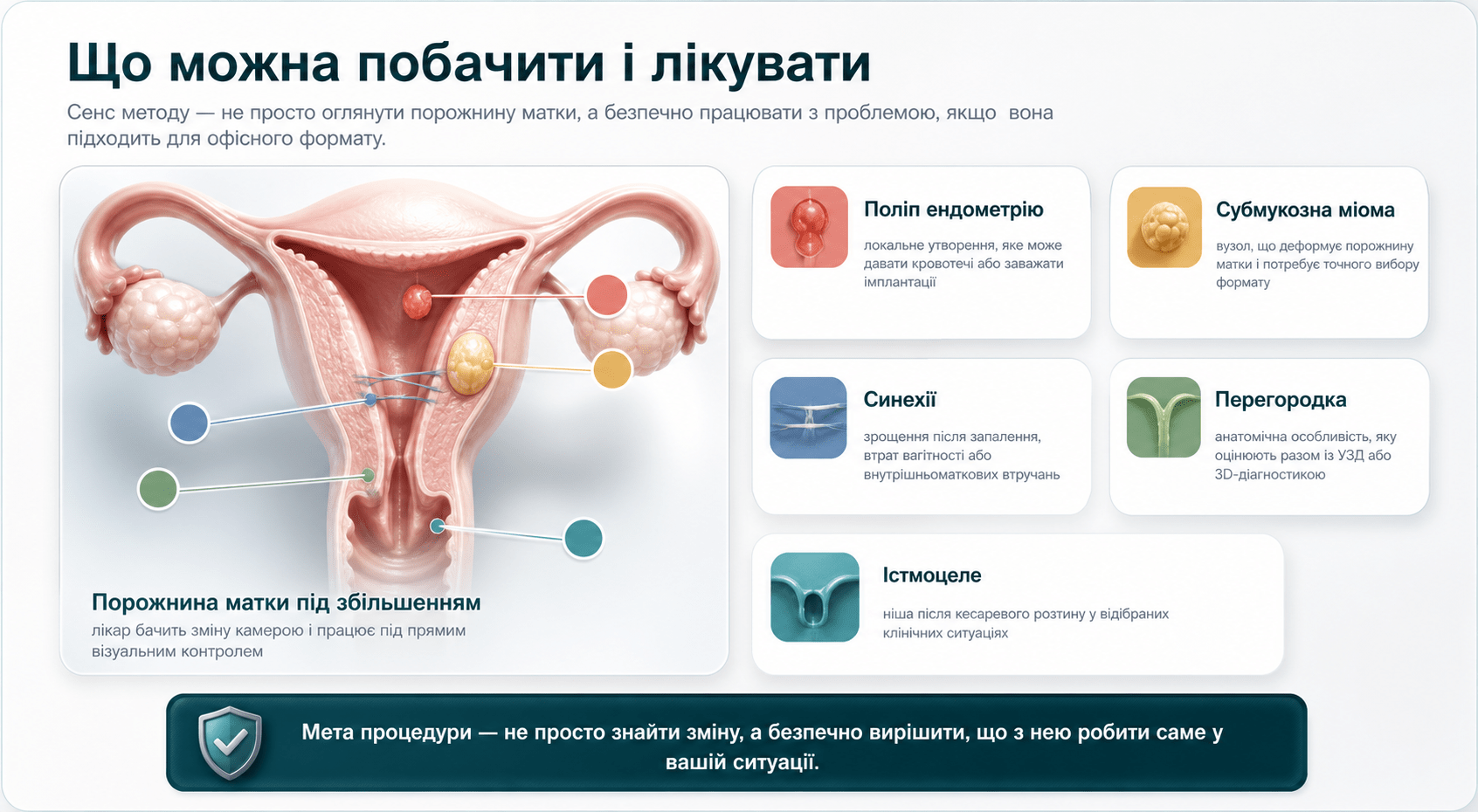 Схема патологій порожнини матки, які може виявляти і лікувати офісна гістерорезектоскопія: поліп, міома, синехії, перегородка, істмоцеле