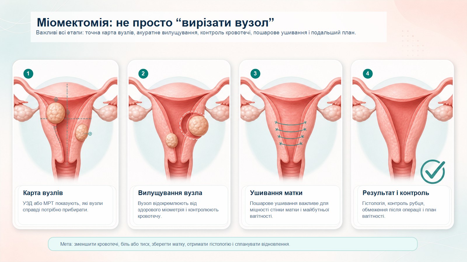 Схема міомектомії: карта вузлів, вилущування, ушивання матки, результат і контроль