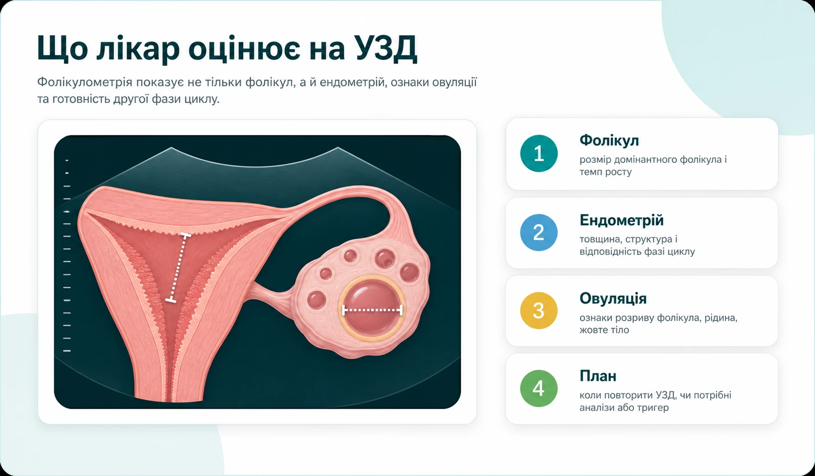 Схема того, що лікар оцінює під час фолікулометрії: фолікул, ендометрій, овуляцію та подальший план