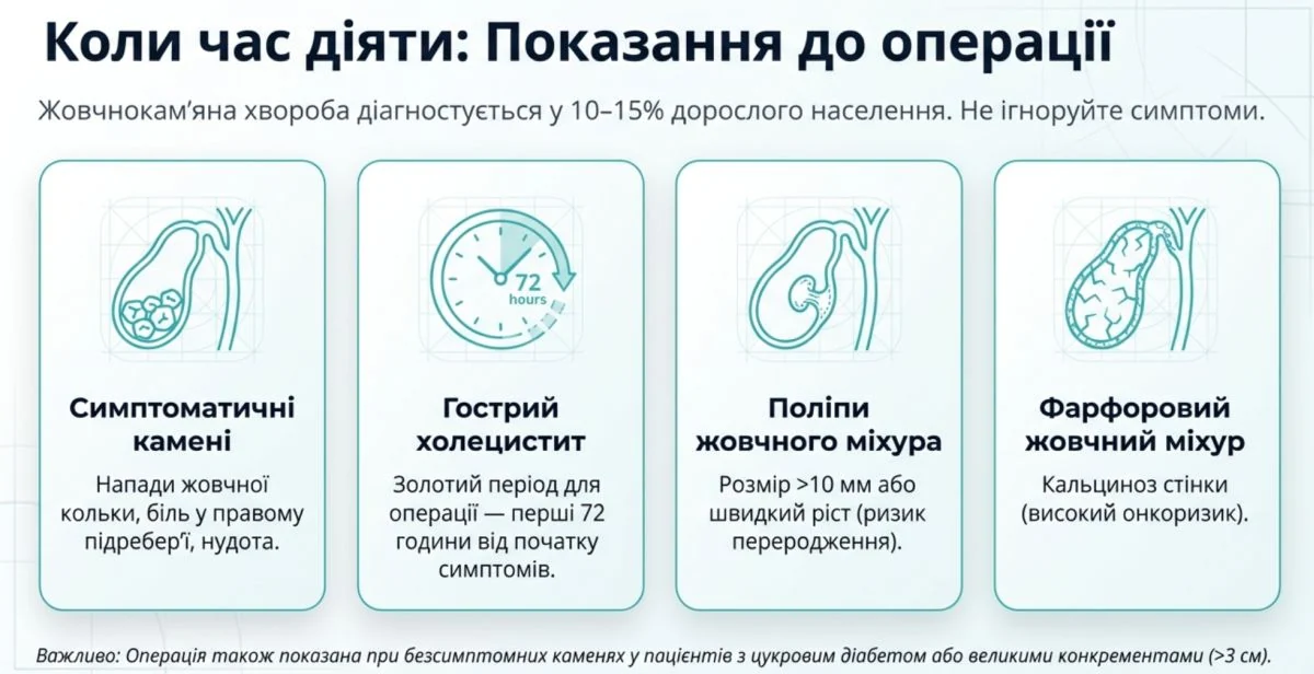 Показання до видалення жовчного міхура: камені, напади болю, холецистит, поліпи та ускладнення